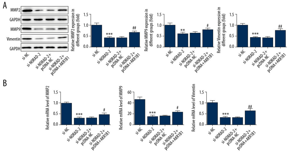 NORAD silencing decreased the expression of migration-related genes in glioma cells. The (A) proteins and (B) mRNA expression of MMP2, MMP9, and vimentin was detected using western blotting and RT-qPCR, respectively. All experiments were repeated three times independently (n=3). ** P<0.01, *** P<0.001 versus si-NC; # P<0.05, ## P<0.01 vs. si-NORAD-2+pcDNA-NC. NORAD – noncoding RNA activated by DNA damage; mRNA – messenger RNA; RT-qPCR – reverse transcription-quantitative polymerase chain reaction; si-NC – negative control for NORAD siRNA; si-NORAD – si-NORAD, small interfering RNAs (siRNAs) against NORAD; pcDNA-NC – empty vector plasmid.