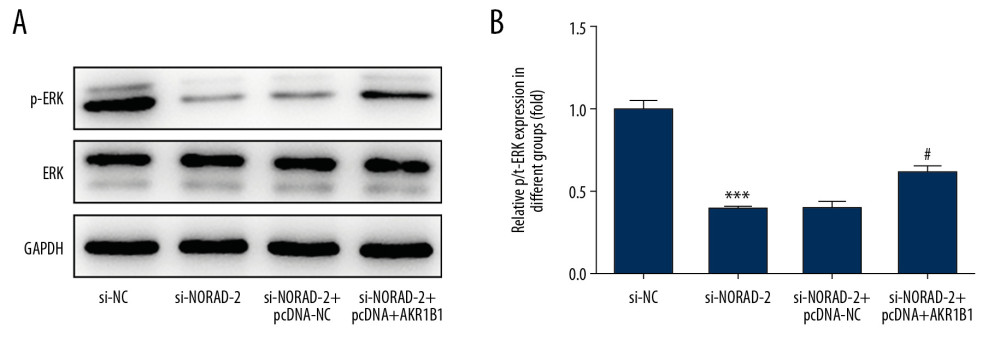 (A, B) NORAD could regulate ERK signaling via targeting AKR1B1. The expression of p-ERK was measured using western blotting. All experiments were repeated 3 times independently (n=3). *** P<0.001 vs. si-NC; # P<0.05 vs. si-NORAD-2+pcDNA-NC. NORAD – noncoding RNA activated by DNA damage; ERK – extracellular signal-regulated kinase; p-ERK – phosphorylated ERK; si-NC – negative control for NORAD siRNA; si-NORAD – small interfering RNAs (siRNAs) against NORAD; pcDNA-NC – empty vector plasmid.