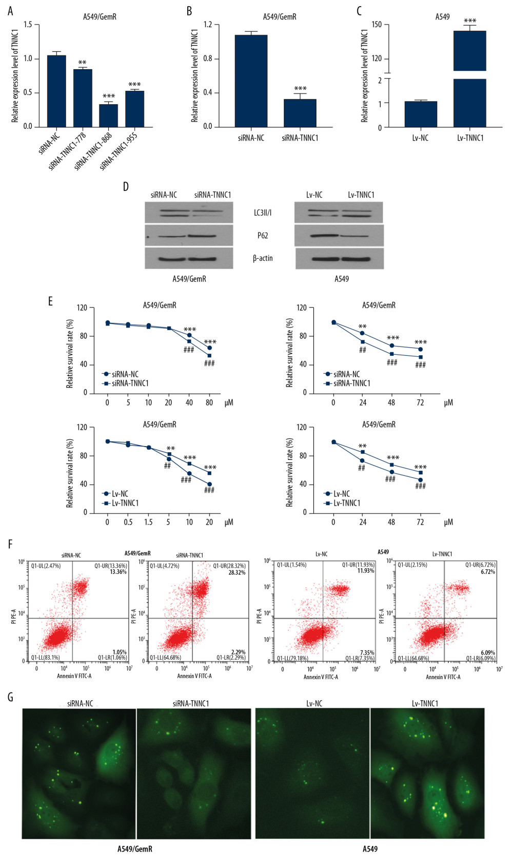 Troponin C1, slow skeletal and cardiac type (TNNC1) overexpression could enhance the sensitivity of A549 cells to gemcitabine (GEM). (A) Detection of the knockout effect of TNNC1. (B) TNNC1 lost model was successfully established in A549/GemR cells by transfecting TNNC1 short interfering ribonucleic acid (siRNA-TNNC1) and negative control RNA (siRNA-NC) respectively by reverse tracscription-quantitative polymerase chain reaction (RT-qPCR) (*** P<0.01). (C) Stable TNNC1-overexpressed cell line was successfully established in A549 cells by infecting with TNNC1 overexpression lentivirus (Lv-TNNC1) or negative control lentivirus (Lv-NC) respectively through RT-qPCR assay (*** P<0.01). (D) Western blot assay was used to evaluate the expression of autophagy-related proteins in A549 and A549/GemR model cells. (E) A549 cells were incubated with increasing concentrations of GEM (0–20 μM) for 24 h; meanwhile A549/GemR cells were incubated with increasing concentrations of GEM (0–80 μM) for 24 h. Cell viability was assessed by 3-(4,5-dimethylthiazol-2-yl)-2,5-diphenyltetrazolium bromide (MTT). A549 were incubated with 5 μM GEM, whereas A549/GemR were incubated with 40 μM GEM. Then cell viability was determined at 24, 48, and 72 h by MTT assay. The results were shown as mean±SD of four independent experiments. (** P<0.01, *** P<0.001, ## P<0.01, ### P<0.001). (F) Flow cytometry with annexin V-fluorescein isothiocyanate/propidium iodide double staining detected apoptosis in A549 and A549/GemR model cells after GEM treatment respectively with 5 μM and 40 μM for 24 h. (G) LC3 puncta accumulation in A549 and A549/GemR model cells after GEM treatment with 5 μM and 40 μM for 24 h, respectively. The original magnification was ×200.