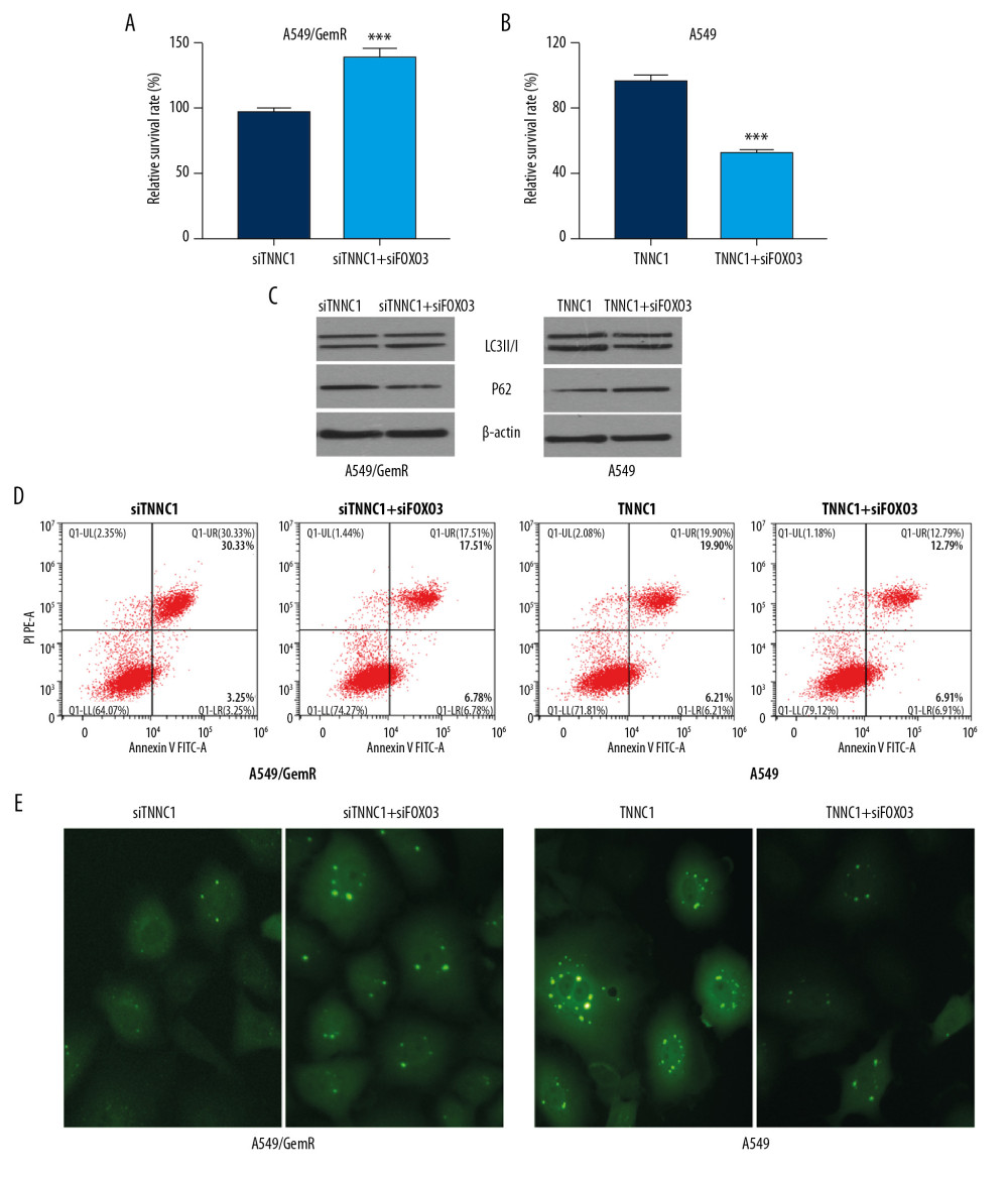 Troponin C1, slow skeletal and cardiac type (TNNC1) promoted autophagy of A549 cells and affected gemcitabine (GEM) sensitivity, which was negatively transcription regulated by forkhead box 03 (FOXO3). A549-overexpressed TNNC1-stable cells were transfected with FOXO3 overexpression plasmid (TNNC1+FOXO3) for 48 h, whereas A549-overexpressed TNNC1-stable cells (TNNC1) were used as controls. At the same time, A549/GemR cells were transfected with TNNC1 short interfering ribonucleic acid (siRNA) (siTNNC1) or TNNC1 siRNA plus FOXO3 siRNA (siTNNC1+siFOXO3) respectively for 48 h. Meanwhile, GEM was incubated for 24 h before testing. (A, B) Cell proliferation of A549 and A549/GemR was determined by 3-(4,5-dimethylthiazol-2-yl)-2,5-diphenyltetrazolium bromide (MTT) assay. The data were presented as the mean±SD (*** P<0.001). (C) Autophagy-related proteins LC3B and P62 were detected by western blot. (D) Apoptosis was investigated by flow cytometry. (E) GFP-LC3 punctate structures were observed and imaged using a fluorescence microscope in A549 and A549/GemR model cells after AAv-mRFP-GFP-LC3 viruses infected them. The original magnification was ×200.