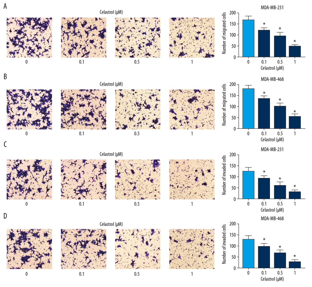 The influence of celastrol on migration and invasion of TNBC cells. (A, B) Cell migration was assessed in MDA-MB-231 and MDA-MB-468 cells after exposure to various doses of celastrol for 24 h by transwell assay. (C, D) Cell invasion was detected after treatment with various doses of celastrol for 24 h via transwell analysis. * P<0.05 vs. the non-treated group (0 μM).