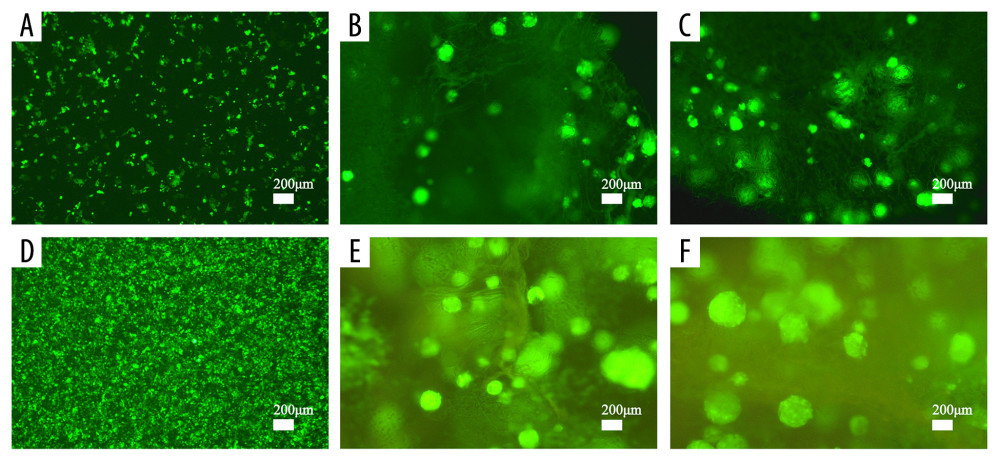 Cell proliferation analyses are accomplished by green fluorescent protein (GFP)-labeled HCT116 cell imaging. HCT-116 cells transfected with pCDH-CMV-MCS-EF1-copGFP-Puro lentivirus (5×109 transduction units/mL) were cultured in the two-dimensional (2D) plate, silk fibroin (SF)/chitosan (Cs) (1: 1) scaffolds, and SF/Cs/alginate (Alg) (1: 1: 1) scaffolds. The scaffolds and the cells are observed under Nikon ECLIPSE Ts2R microscope and images are taken on day 3 (A–C) and day 7 (D–F). 2D group (A, D), SF/Cs (1: 1) group (B, E), SF/Cs/Alg (1: 1: 1) group (C, F).