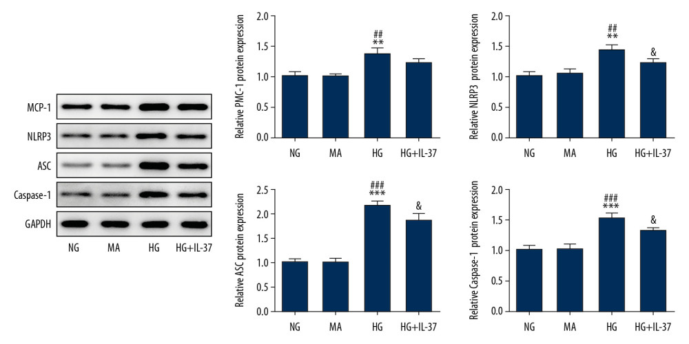 IL-37 reduces inflammation of high glucose-treated podocytes. The expression levels of the inflammatory proteins MCP-1, NLRP3, ASC, and caspase-1 were detected by western blot. ** p<0.01, *** p<0.001 vs. NG; ## p<0.01, ### p<0.001 vs. MA; & p<0.05 vs. HG. NG – normal glucose group (medium with 5.5 mM glucose); MA – mannitol-treated podocytes used as the osmotic pressure control group; HG – high-glucose group (medium with 30 mM glucose).