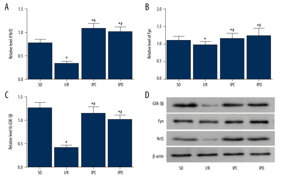 Analysis of GSK-3β/Fyn/Nrf2 protein levels in liver tissue. Rats were divided into the SO group, I/R group, IPC group, and IPO group. Western blot analysis was used to detect the protein levels. (A–C) Quantitative Western blot results of (A) Nrf2, (B) Fyn, and (C) GSK-3β in liver tissues are shown. (D) Representative Western blot results. Compared with SO, * P<0.05; compared with I/R, # P<0.05.