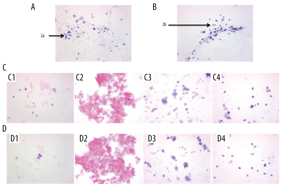 Vaginal smears in Letrozole+HFD, Letrozole, HFD, and control groups of rats. (A) Vaginal smear from a Letrozole+HFD rat. (B) Vaginal smear from a Letrozole rat. 2a & 2b – leukocytes. (C) Vaginal smears from an HFD rat, showing a regular estrus cycle. (D) Vaginal smears from a control rat, showing a regular estrus cycle. C1, D1 – proestrus; C2, D2 – estrus; C3, D3 – metestrus; C4, D4 – diestrus.