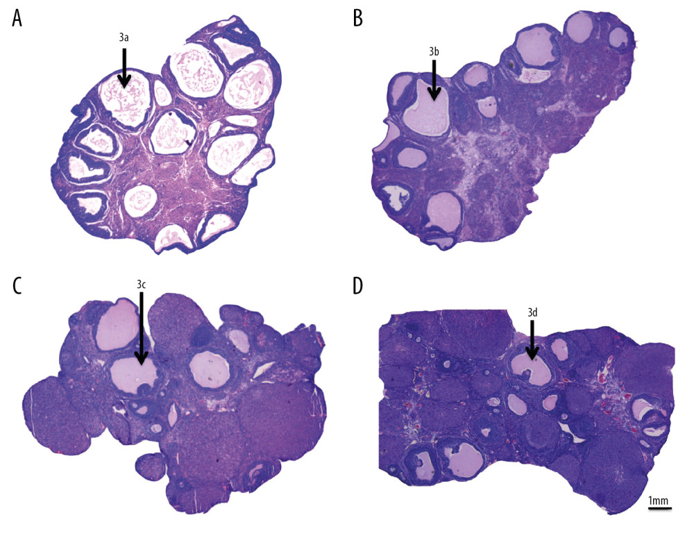 Ovarian morphology in Letrozole+HFD, Letrozole, HFD and control groups of rats. (A) Ovary from a Letrozole+HFD rat. (B) Ovary from a Letrozole rat. (C) Ovary from an HFD rat. (D) Ovary from a control rat. 3a & 3b – atretic follicles; 3c &3 d – graafian (tertiary) follicles.