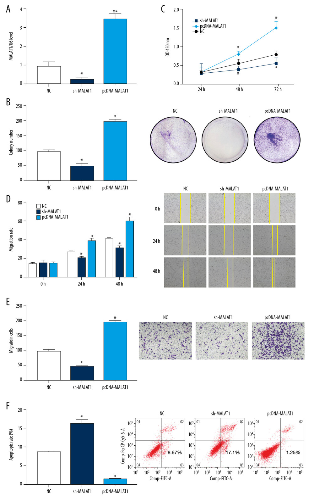 Silencing of long-chain non-coding RNA metastasis-related lung adenocarcinoma transcript 1 (lncRNA MALAT1) significantly inhibits the proliferation and migration of hPASMCs. (A) Levels of lncRNA MALAT1 expression in hPASMCs with silenced and overexpressed lncRNA MALAT1. (B) Numbers of clones formed by hPASMCs with silenced and overexpressed lncRNA MALAT1. (C) Cell counting kit-8 (CCK-8) assays of the proliferation of hPASMCs with silenced and overexpressed lncRNA MALAT1. (D) Wound healing assay assessing the effect of lncRNA MALAT1 silencing and overexpression on the migration ability of hPASMC cells. (E) Transwell assays assessing the effect of lncRNA MALAT1 silencing and overexpressed on the migration of hPASMC cells. (F) Flow cytometry assays of the effect of lncRNA MALAT1 silencing and overexpression on hPASMC cell apoptosis.* p<0.05, ** p<0.01 compared with the no template control (NC) group.