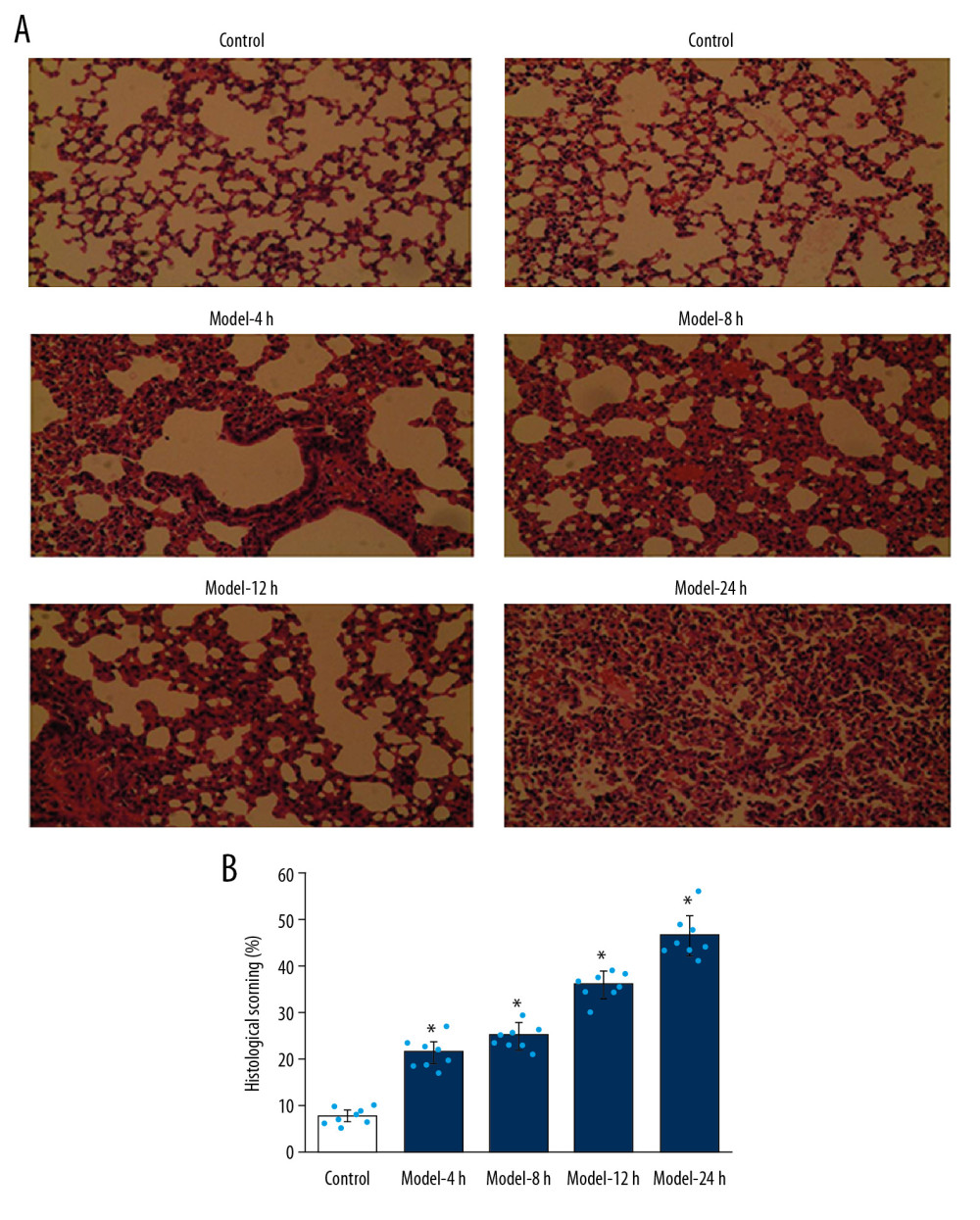 Pathological changes of inflammations in lung tissues for the ALI mouse models in different groups according to HE staining. (A) HE staining images. (B) Statistical analysis of histological scores for HE-stained images. Magnification, 100×. * p<0.05 vs. Control group.