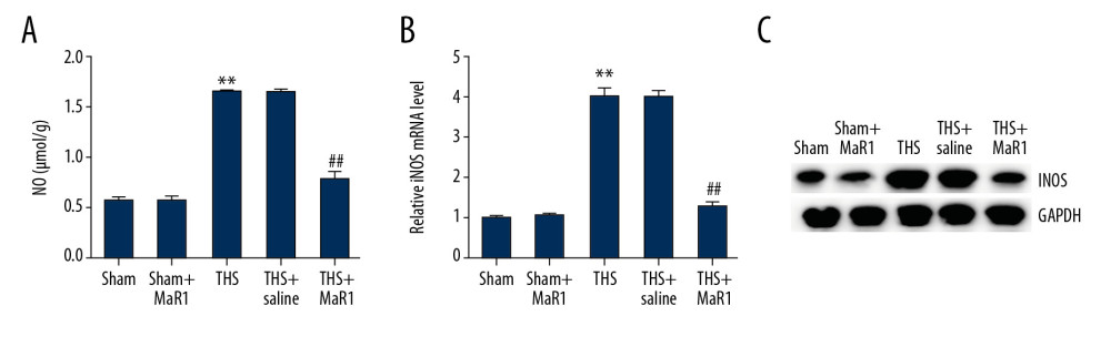 MaR1 increased NO concentrations and iNOS levels in THS-induced lung tissues. MaR1 or physiological saline were injected into THS-induced lung injury models. (A) The levels of NO were assessed. (B) qRT-PCR was used to measure the iNOS mRNA levels. (C) Western blot assay was adopted to assess the iNOS protein expression. ** P<0.01 versus Sham; #, ## P<0.01 versus THS+saline group. MaR1 – Maresin-1; NO – nitrogen oxide; iNOS – inducible nitric oxide synthase; THS – trauma hemorrhagic shock; qRT-PCR – quantitative real-time polymerase chain reaction; mRNA – messenger RNA.