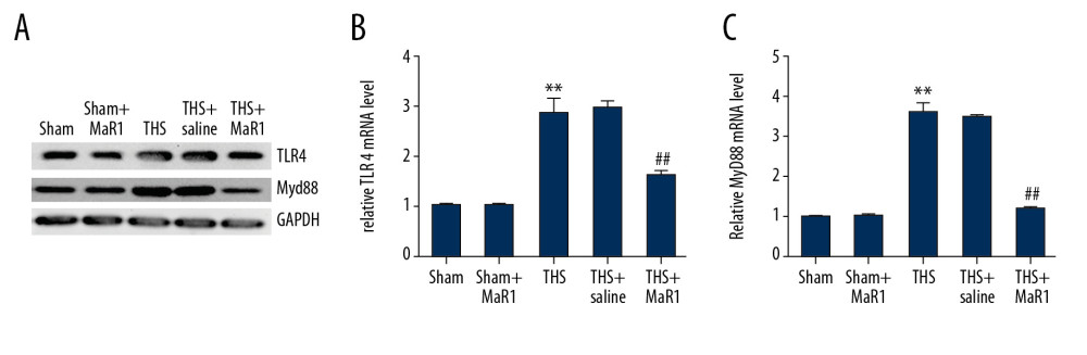 MaR1 suppressed the activation of TLR4 and MyD88 expression in acute lung injury stimulated by THS. Western blot assay and qRT-PCR analyses were adopted to evaluate the relative genes expressions in different groups. (A) TLR4 and MyD88 protein expressions in lung tissues were assessed by western blot assay. TLR4 (B) and MyD88 (C) mRNA levels were determined using qRT-PCR. ** P<0.01 versus Sham; #, ## P<0.01 versus THS+saline group. MaR1 – Maresin-1; THS – trauma hemorrhagic shock; qRT-PCR – quantitative real-time polymerase chain reaction; mRNA – messenger RNA.