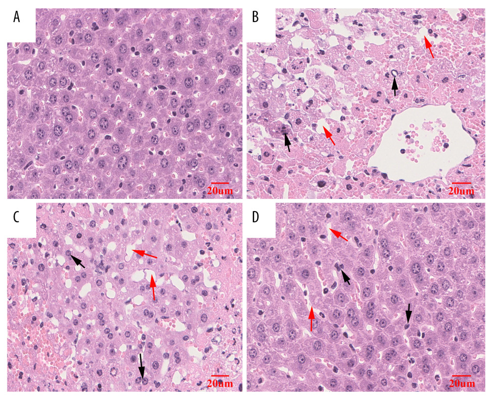 Histological analysis of liver injury induced by carbon tetrachloride (CCl4) and the effects of quercetin (Que) in mice. (A) Control mice; (B) Mice treated with CCl4; (C, D) Mice treated with (C) low dose (60 mg/kg) or (D) high dose (120 mg/kg) Que prior to treatment with CCl4. The red arrows indicate vacuoles and the black arrows indicate inflammatory cell aggregates. (hematoxyline and eosin (H&E) staining; magnification, 100×).