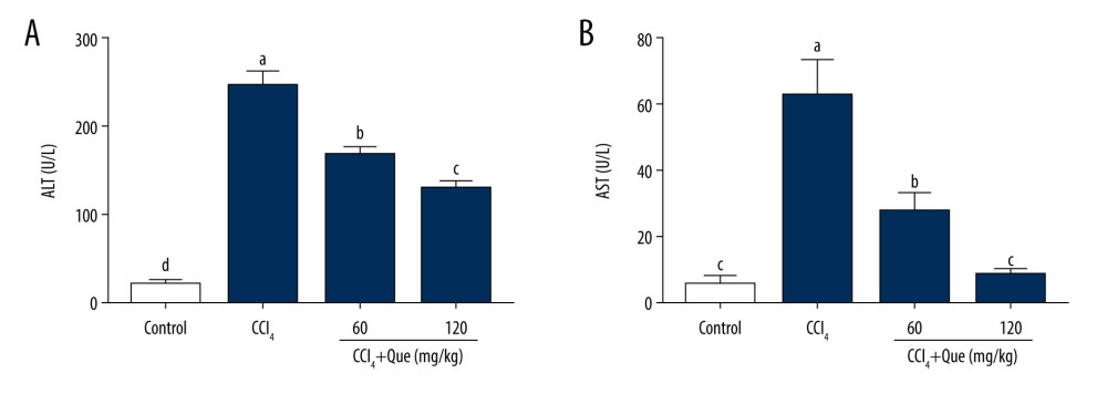 Effects of carbon tetrachloride (CCl4) and quercetin (Que) on the activities of serum (A) aspartate aminotransferase (AST) and (B) alanine aminotransferase (ALT). Con, control mice; CCl4: mice treated with 0.2% CCl4 (10 mL/kg). All data were expressed as mean±standard deviation (SD) (n=5). Columns labeled with different letters indicate significant difference among groups (p<0.05).