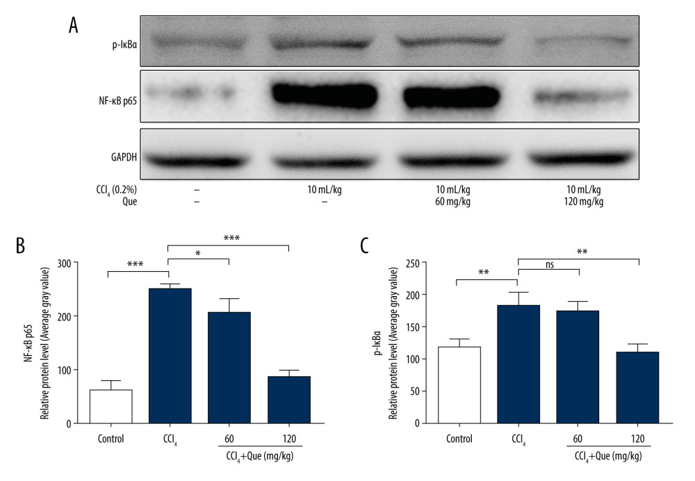 Effects of carbon tetrachloride (CCl4) and quercetin (Que) on protein expression of nuclear factor-kappa B (NF-κB) p65 and phosphorylated IκBα (p-IκBα) in hepatic tissue of mice. (A) Western blotting analysis of NF-κB p65 and p-IκBα. (B) Quantification of the relative protein expression levels of NF-κB p65 and p-IκBα. All data were expressed as mean ±standard deviation (SD) (n=5). * p<0.05, ** p<0.01 and ***p<0.001 compared with the mice treated with carbon tetrachloride (CCl4).