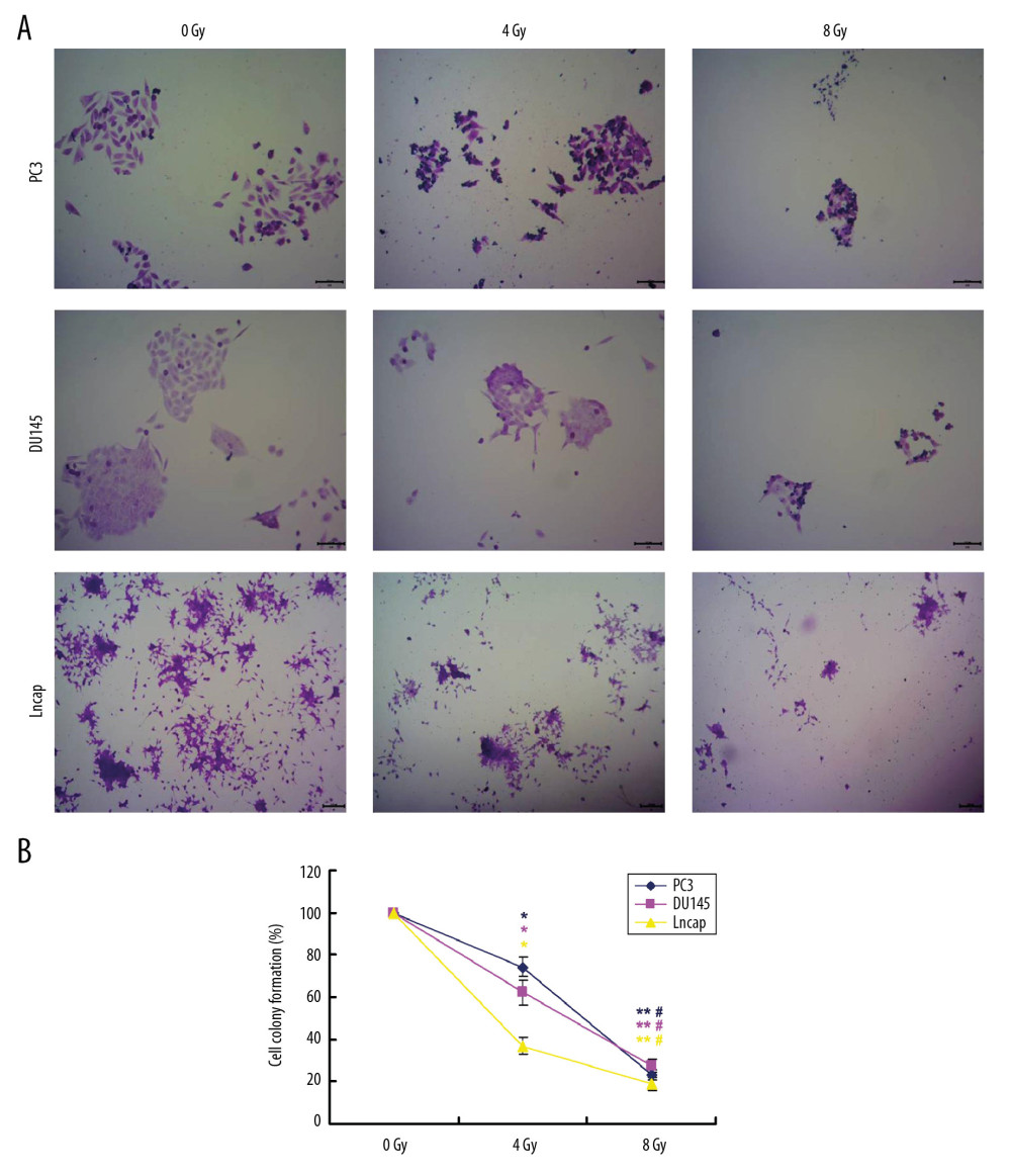 The irradiation administration significantly reduced colony formation of PC-3, DU145 and Lncap cells. (A) Colony formation images for PC-3, DU145, and Lncap cells. (B) Statistical analysis for colony formation of PC-3, DU145, and Lncap cells undergoing irradiation treatment. * P<0.05, ** P<0.01 versus 0 Gy group, # P<0.05 versus 4 Gy group.