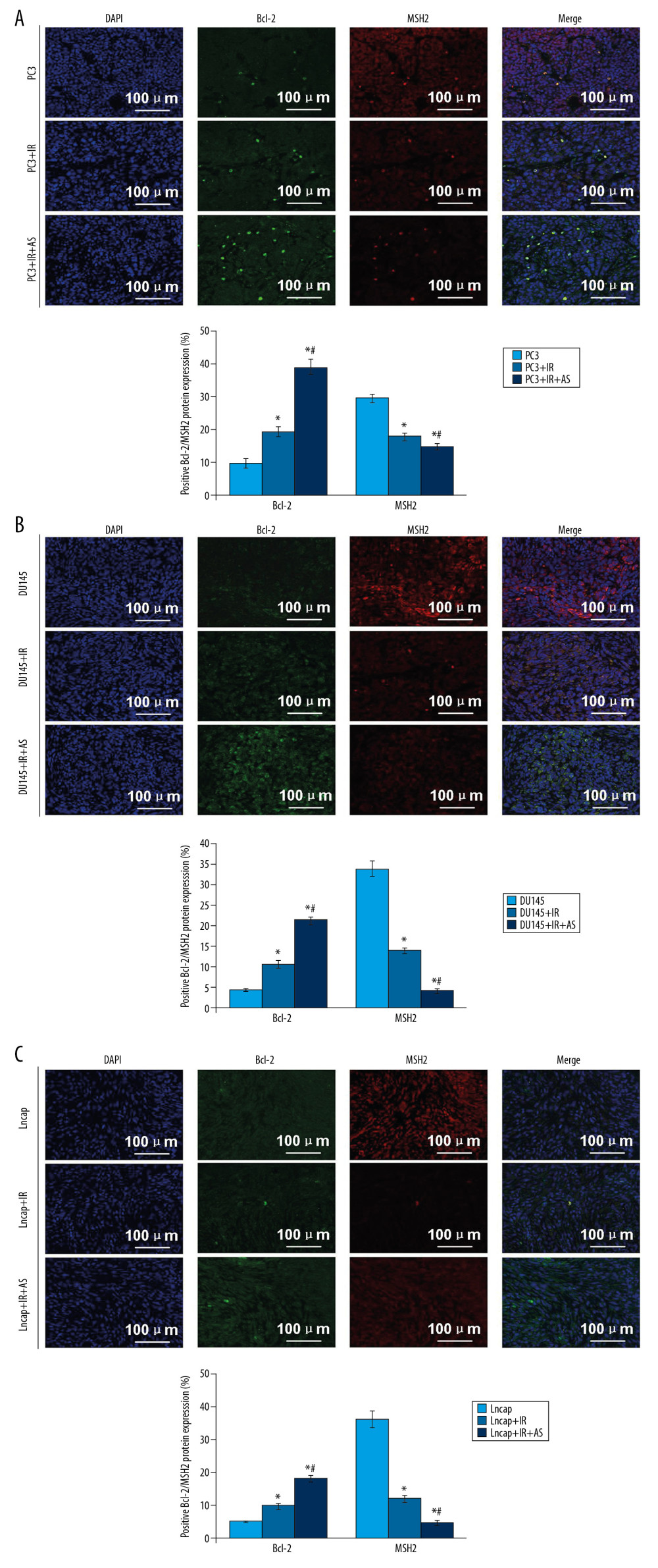Observation for the interaction between Bcl-2 and MSH2 in tumor tissues of xenograft tumor mice using immuno-fluorescence assay. (A) Expression of Bcl-2 and MSH2 in tumor tissues of PC3-transplanted xenograft tumor mice. (B) Expression of Bcl-2 and MSH2 in tumor tissues of DU145-transplanted xenograft tumor mice. (C) Expression of Bcl-2 and MSH2 in tumor tissues of Lncap-transplanted xenograft tumor mice. * P<0.05 versus PC3 or DU145 or Lncap group. # P<0.05 versus PC3+IR or DU145+IR or Lncap+IR group. The scale bars were illustrated in images.