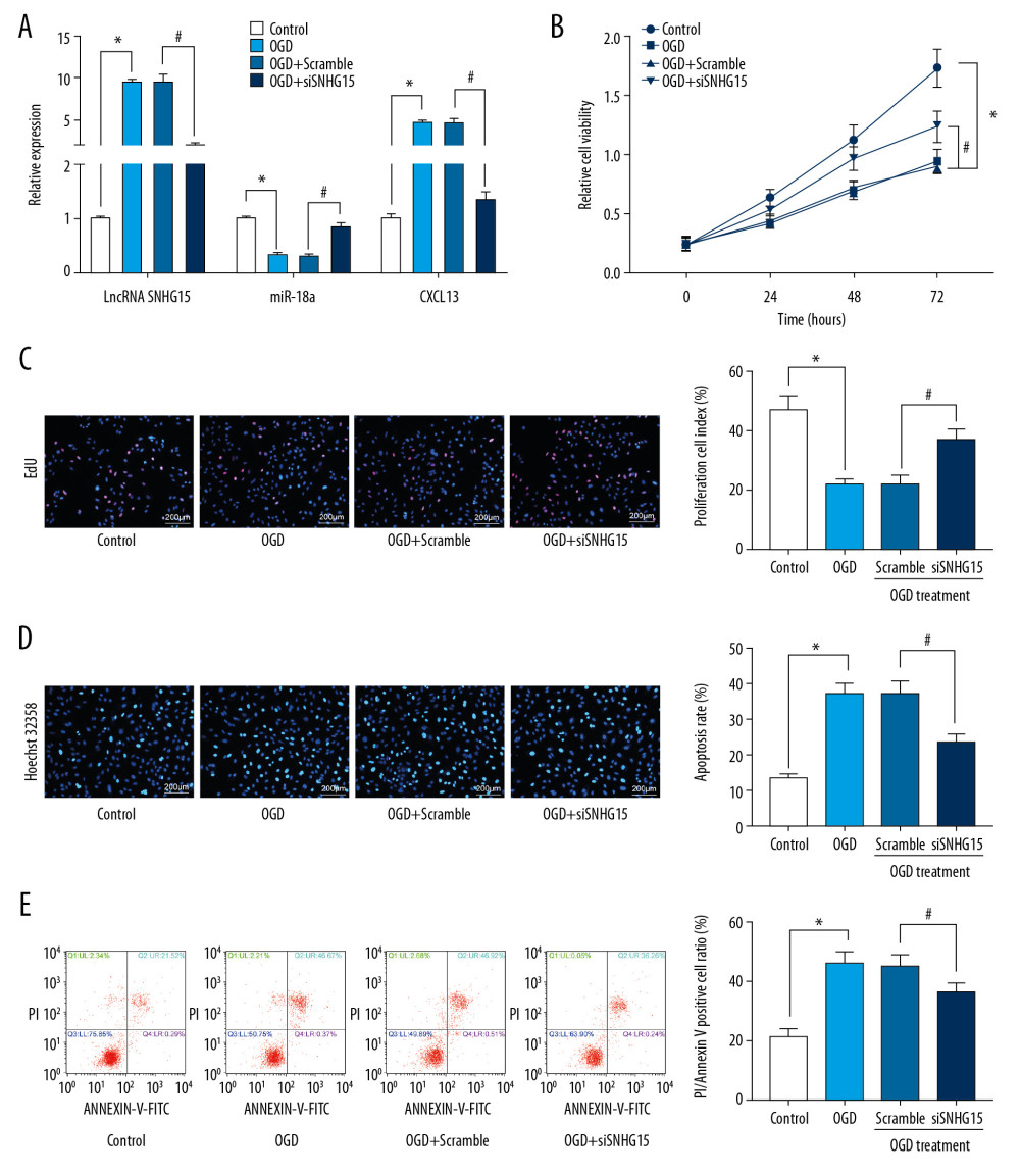 Silencing of SNHG15 inhibits OGD-induced N2a cell apoptosis. N2a cells were subjected to OGD treatment and collected for experiments. (A) Expression of SNHG15, miR-18a, and CXCL13 in cells before and after si-SNHG1 treatment was detected using RT-qPCR. (B, C) Viability of N2a cells was detected using MTT and EdU labeling assays. (D, E) Apoptosis of N2a cells was detected using Hoechst 33258 staining and flow cytometry. Data were shown as mean±SD based on 3 independent experiments. * p<0.05. In panels A, C–E, data were analyzed using one-way ANOVA while data in panel B were analyzed using two-way ANOVA, and Tukey’s multiple comparison test was used for post hoc analysis.