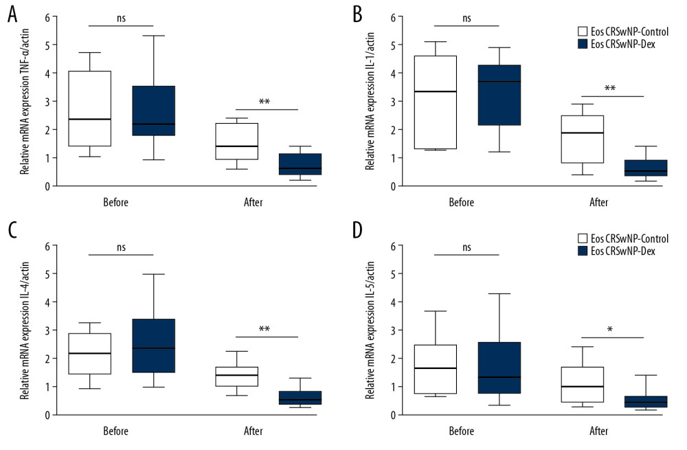 Expression of TNF-α, IL-1, IL-4, and IL-5 in Eos CRSwNP patients with or without DEX treatment. (A–D) qRT-PCR results displayed after DEX treatment, the expression of TNF-α, IL-1, IL-4, and IL-5 were all significantly increased in Eos CRSwNP patients. * P<0.05; ** P<0.01. TNF – tumor necrosis factor; IL – interleukin; qRT-PCR – quantitative real-time polymerase chain reaction; DEX – dexamethasone; Eos CRSwNP – eosinophilic chronic rhinosinusitis with nasal polyps.