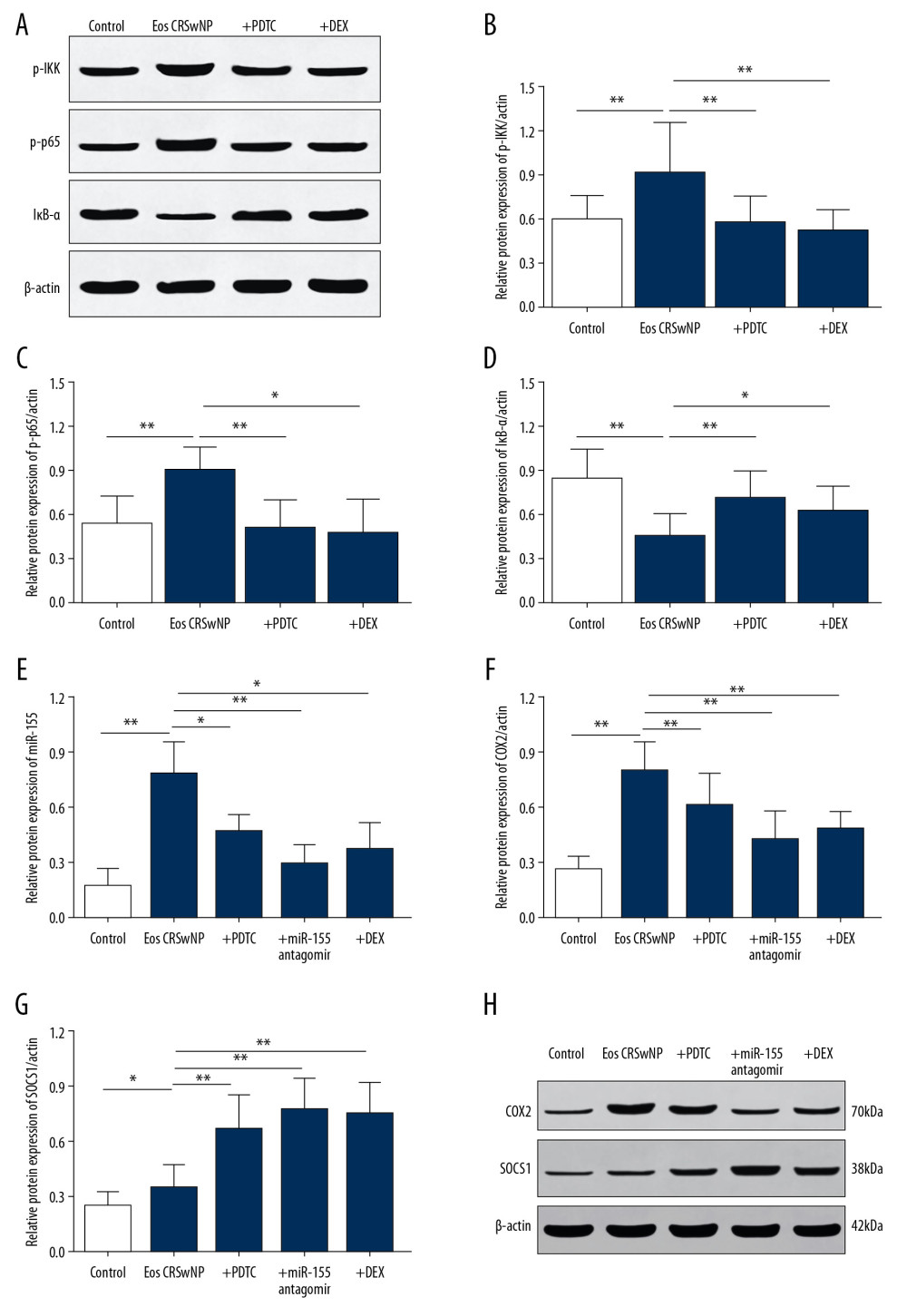 Expression of NF-κB/miR-155 in mice model of Eos CRSwNP. (A) Western blot analysis of p-IKK, p-p65, and IκB-α in control, Eos CRSwNP, PDTC, and DEX groups. (B–D) Statistical analysis displayed the expression of p-IKK and p-p65 were significantly increased while the expression of IκB-α was decreased in the Eos CRSwNP group. However, the application of PDTC or DEX reversed the expression alterations, which was similar with the control group. (E) The expression of miR-155 was significantly increased in the Eos CRSwNP group. The application of PDTC, miR-155 antagomir, or DEX abolished the elevation of miR-155 in the Eos CRSwNP group. (F, G) Statistical analysis showed that after application of PDTC, miR-155 antagomir, or DEX, the expression of COX2 was significantly decreased while the expression of SOCS1 was significantly increased in the Eos CRSwNP group. (H) Western blot analysis of COX2 and SOCS1 in groups. * P<0.05; ** P<0.01. NF-κB – nuclear factor κB; Eos CRSwNP – eosinophilic chronic rhinosinusitis with nasal polyps; DEX – dexamethasone; PDTC – pyrrolidine dithiocarbonate.