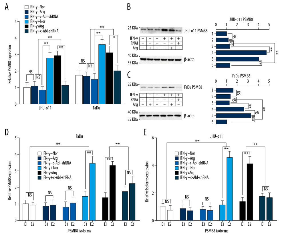 Effect of targeted silencing of the c-Abl gene on the mRNA and protein levels of PSMB8 and its alternatively spliced isoforms. (A) JHU-011 cells and FaDu cells were divided into 6 groups (described previously). In the 3 groups with IFN-γ (final concentration of 150 U/μl), the transcription of PSMB8 in the IFN-γ+/Nor group and the IFN-γ+/Arg group was significantly upregulated but was inhibited in the IFN-γ+/c-Abl-shRNA group due to the targeted silencing of the c-Abl gene (** P<0.01). (B) PSMB8 protein expression levels were detected in JHU-011 cells by Western blotting, and the ImageJ software was used to determine the gray value and drew a histogram. Lanes 1–6 represent IFN-γ−/RNAi−/Arg−, IFN-γ−/RNAi−/Arg+, IFN-γ−/RNAi+/Arg−, IFN-γ+/RNAi−/Arg−, IFN-γ+/RNAi−/Arg+, and IFN-γ+/RNAi+/Arg−, respectively. The results show that the PSMB8 protein expression level was inhibited in the IFN-γ+/RNAi+/Arg− group (** P<0.01). (C) The PSMB8 protein expression level was inhibited in the IFN-γ+/RNAi+/Arg- group of FaDu cells (** P <0.01). (D) FaDu cells were divided into 6 groups. RT-PCR was performed to determine the ratio between E1 and E2 in each group. The transcription level of isoform E2 was significantly upregulated by IFN-γ (** P<0.01). The targeted silencing of c-Abl gene (IFN-γ+/c-Abl-shRNA) downregulated the transcription of E2 (** P<0.01). (E) JHU-011 cells were divided into 6 groups. RT-PCR was performed to determine the ratio between E1 and E2 in each group, and the results were consistent with those of FaDu cells (** P<0.01). Each group contained 3 independent replicates. Quantitative data are expressed as the mean±SD.