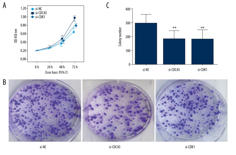 CDK1 or CDCA5 knockdown reduced cell proliferation in MGC-803. (A) The CCK-8 measurement results for the cells transfected with si-NC, si-CDCA5 and si-CDK1 at 0, 24, 48, and 72 hours, respectively. (B) The cell colon formation results for cells transfected with si-NC, si-CDCA5 and si-CDK1. (C) The cell colony number for cells transfected with si-NC, si-CDCA5 and si-CDK1 (** P<0.01).
