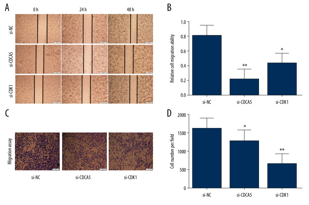 CDK1 or CDCA5 knockdown suppressed cell migration in MGC-803. (A) The cell scratch assay results for the cells transfected with si-NC, si-CDCA5 and si-CDK1 at 0, 24, 48 hours, respectively. (B) Relative cell migration ability of cells transfected with si-NC, si-CDCA5 and si-CDK1 at 48 hours (* P<0.05 and ** P<0.01). (C) The Transwell migration assay for cells transfected with si-NC, si-CDCA5 and si-CDK1, respectively. (D) The cell number per field for cells transfected with si-NC, si-CDCA5 and si-CDK1 (* P<0.05 and ** P<0.01).