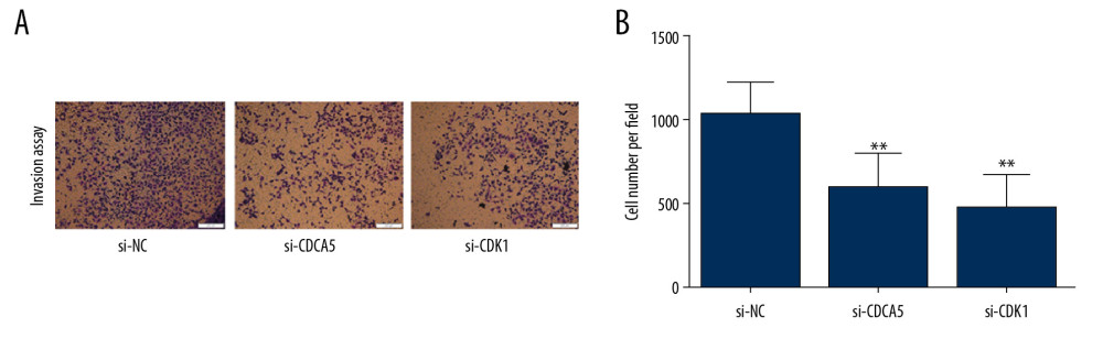 CDK1 or CDCA5 knockdown inhibited cell invasion in MGC-803. (A) The Transwell invasion assay for cells transfected with si-NC, si-CDCA5 and si-CDK1, respectively. (B) The cell number per field for cells transfected with si-NC, si-CDCA5 and si-CDK1 (** P<0.01).