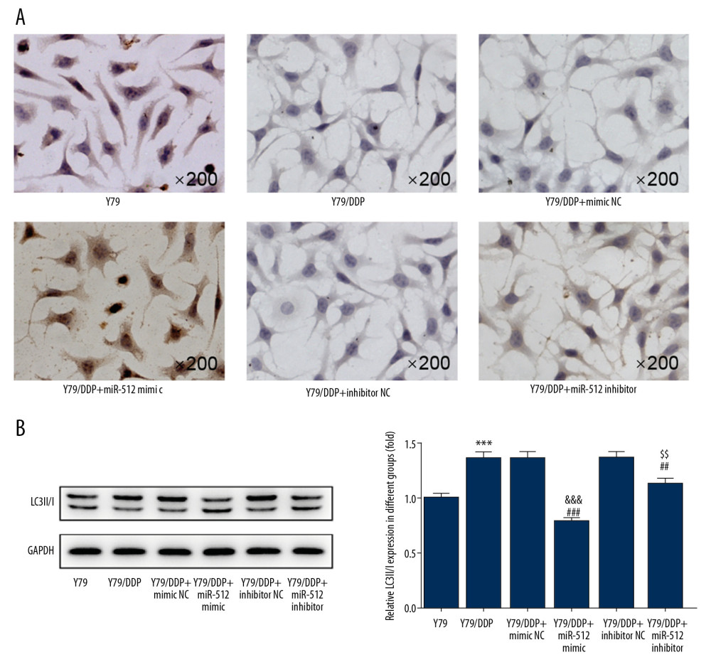 miR-512-3p affects the apoptosis and autophagy of Y79/DDP cells. (A) The apoptosis of Y79/DDP cells after transfection was determined by TUNEL assay. (B) The proteins expression of autophagy in Y79/DDP cells after transfection was detected by Western blot analysis. *** P<0.001 vs. Y79 group. ## P<0.01 and ### P<0.001 vs. Y79/DDP group. ΔΔΔ P<0.001 vs. Y79/DDP+mimic NC group. $$ P<0.01 vs. Y79/DDP+inhibitor NC group.