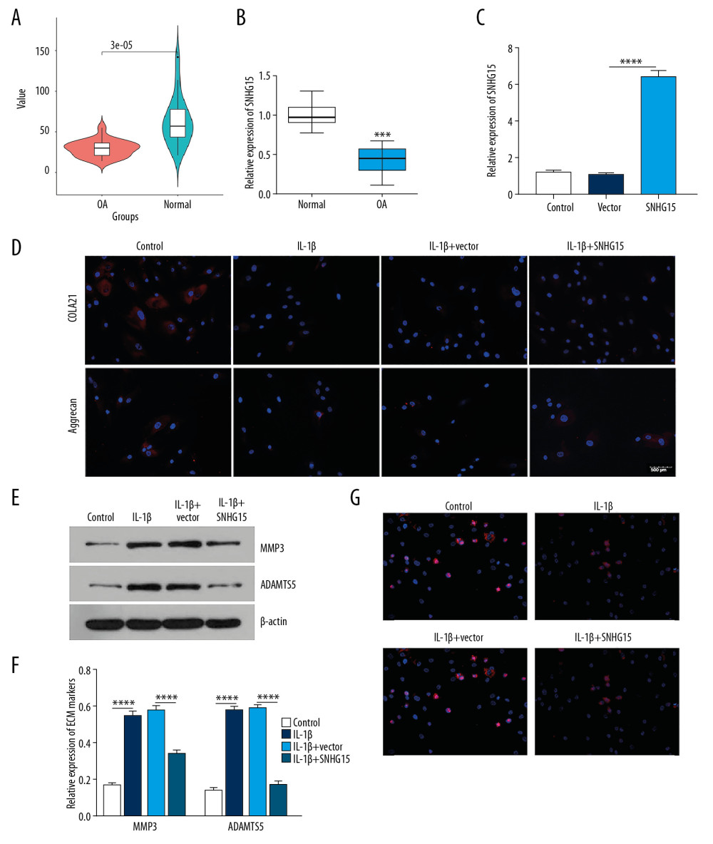 SHNG15 was downregulated in OA knee cartilage tissues and its overexpression inhibited ECM degradation and promoted chondrocyte formation in IL-1β-induced chondrocytes. (A) SNHG15 expression in human OA and normal cartilage tissues using GSE114007. (B) qRT-PCR showing the expression of SNHG15 in human OA and normal cartilage tissues. (C) Transfection efficiency of SNHG15 overexpression vector in chondrocytes. (D) Immunofluorescence assay results showing the expression levels of COL2A1 and Aggrecan in IL-1β-stimulated chondrocytes transfected by SNHG15 overexpression. (E, F) Western blot assay showing MMP3 and ADAMTS5 expression in IL-1β-stimulated chondrocytes transfected by SNHG15 overexpression. (G) The Ki67 expression in IL-1β-stimulated chondrocytes transfected by SNHG15 overexpression using immunofluorescence assay. *** p<0.001, **** p<0.0001.