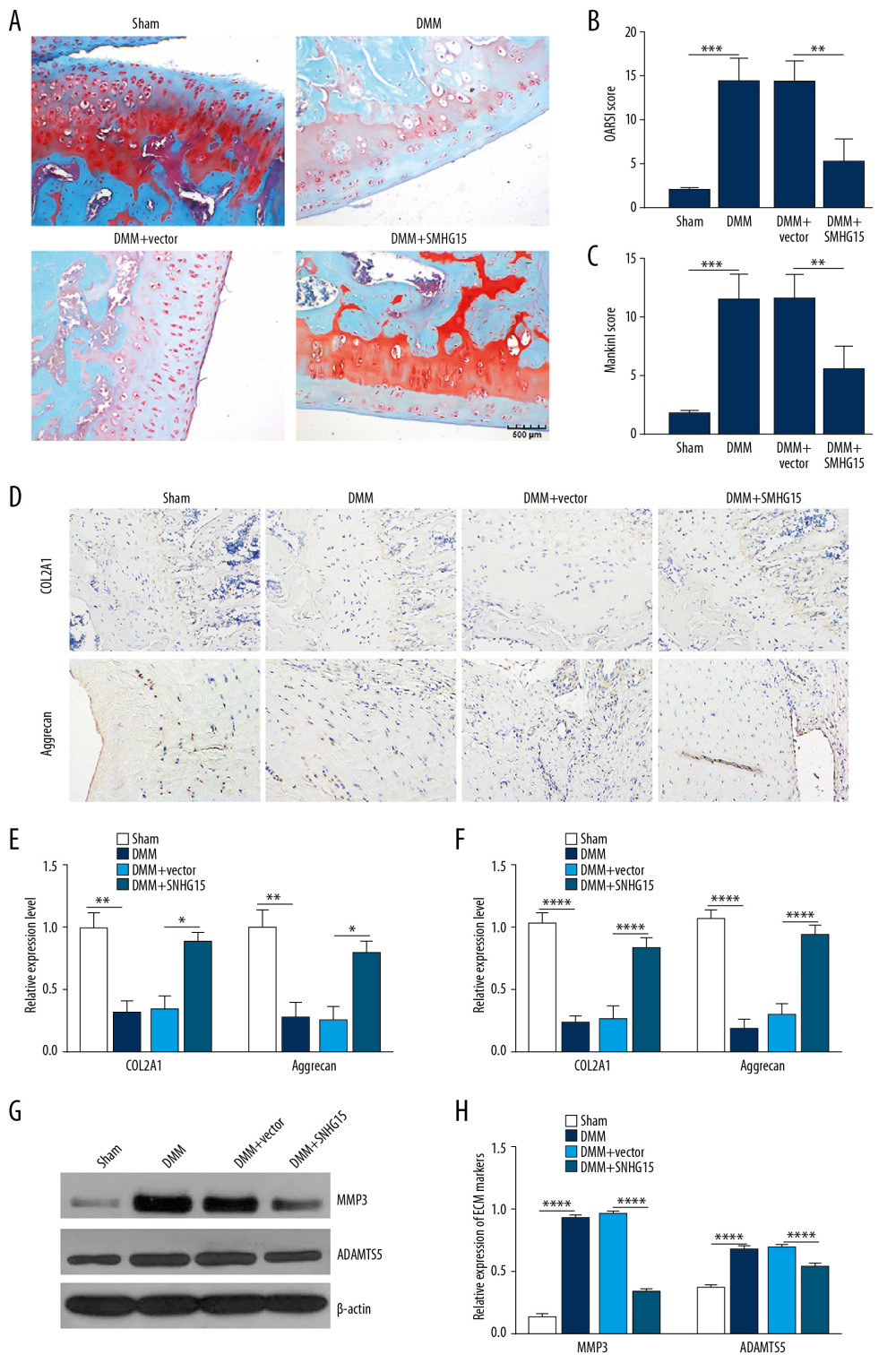 SNHG15 overexpression inhibited ECM degradation and promoted chondrocyte formation in an experimental OA model. (A) The morphology changes of cartilage tissues in the experimental OA model injected by SMHG15 overexpression using Safranin-O and fast green staining. (B, C) Cartilage destruction was assessed according to the OARSI and Mankin scores. (D) Representative images of immunohistochemistry of COL2A1 and Aggrecan in cartilage tissues of the experimental OA model injected by SMHG15 overexpression. Scale bar: 50 μm. Magnification: 200×. (E) Quantitative results of immunohistochemistry for COL2A1 and Aggrecan. (F) COL2A1 and Aggrecan expression in cartilage tissues of experimental OA model injected by SMHG15 overexpression using qRT-PCR. (G, H) MMP3 and ADAMTS5 expression in cartilage tissues of experimental OA model injected by SMHG15 overexpression using western blot. * p<0.05; ** p<0.01, *** p<0.001; **** p<0.0001.