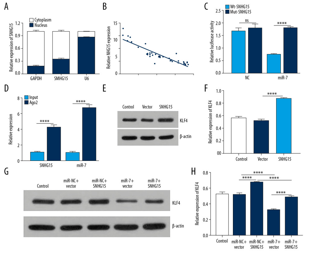 SNHG15 indirectly regulates KLF4 expression by miR-7. (A) The distribution of SNHG15 in subcellular fractions of chondrocytes was evaluated by qRT-PCR. U6 and GAPDH served as nuclear and cytoplasmic markers, respectively. (B) Correlation analysis results showed that SNHG15 was negatively correlated with miR-7. (C, D) Luciferase reporter assay and RIP confirmed that SNHG15 was a target of miR-7. (E, F) SNHG15 overexpression significantly promoted the expression levels of KLF4 in IL-1β-induced chondrocytes as shown by Western blot. (G, H) MiR-7 significantly reversed the elevated expression of SNHG15 on KLF4 expression in IL-1β-induced chondrocytes as shown by Western blot. **** p<0.0001.