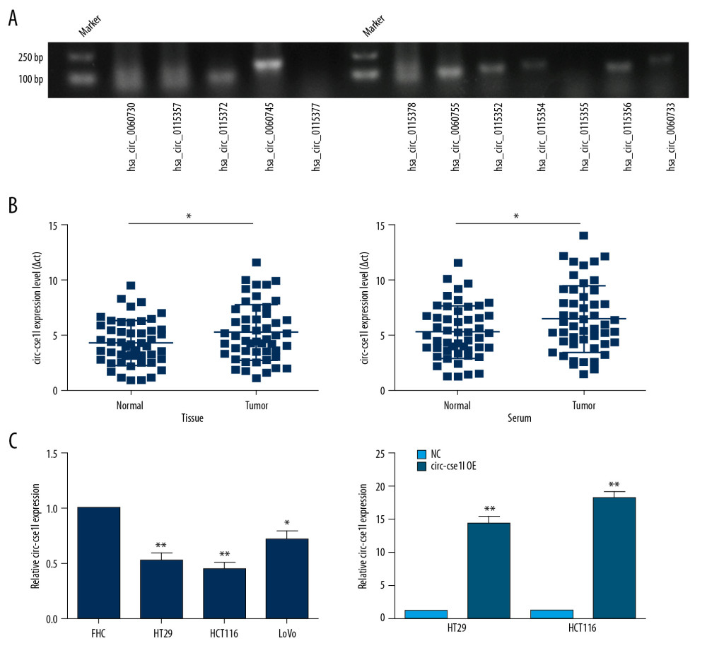 Medical Science Monitor | Circ_cse1l Inhibits Colorectal Cancer ...