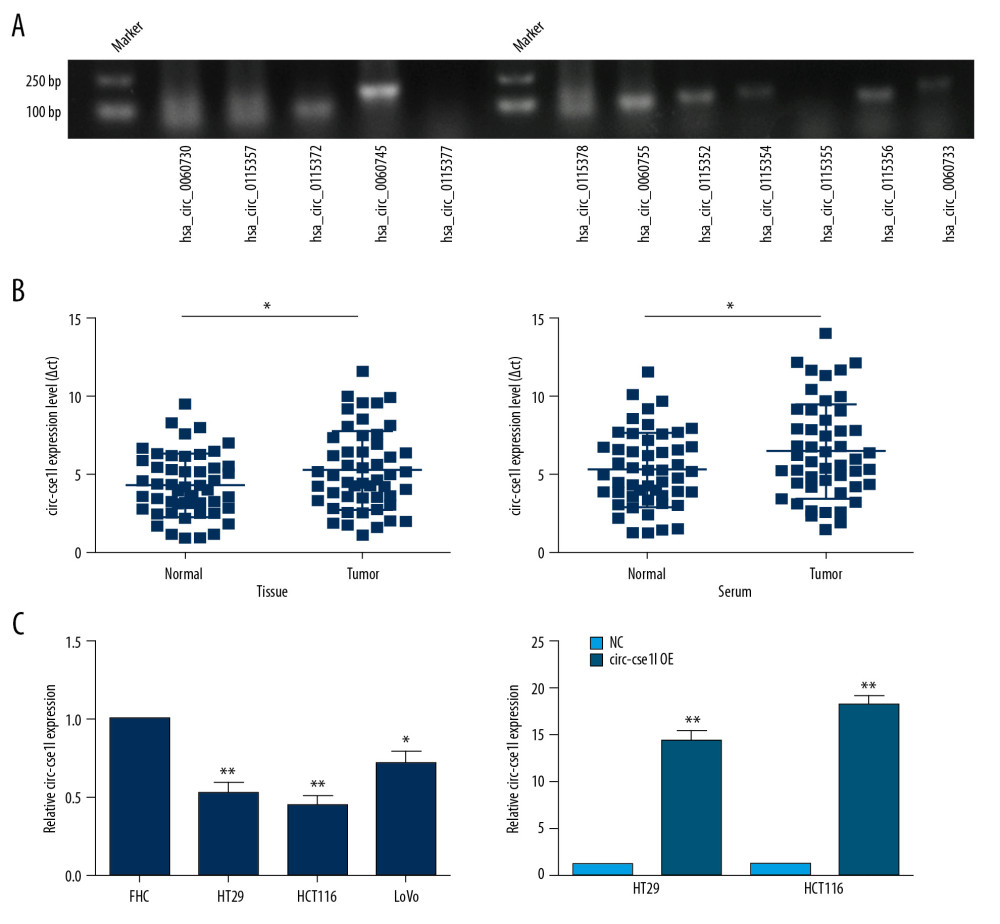 Downregulation of circ_cse1l expression in CRC, as shown by qRT-PCR. (A) Expression in CRC of 12 circRNAs encoded by the CSE1L gene. (B) Relative expression of circ_cse1l in tissue and serum samples from patients with CRC and normal controls. (C) Expression of circ_cse1l in FHC, HT29, HCT116, and LoVo cells and after transfection of the circ_cse1l overexpression vector and empty vector (NC) into HT29 and HCT116 cells. * P<0.05, ** P<0.01.
