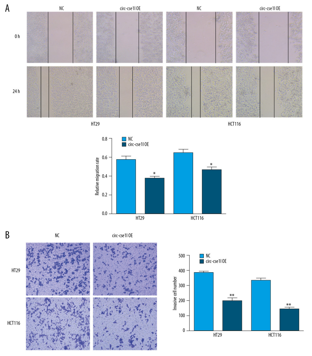 Overexpression of circ_cse1l inhibits the ability of CRC cells to migrate and invade. HT29 and HCT116 cells were transfected with a circ_cse1l overexpression vector and an empty vector (NC). Overexpression of circ_cse1l reduced the (A) migration and (B) invasion of HT29 and HCT116 cells. *P<0.05, ** P<0.01.