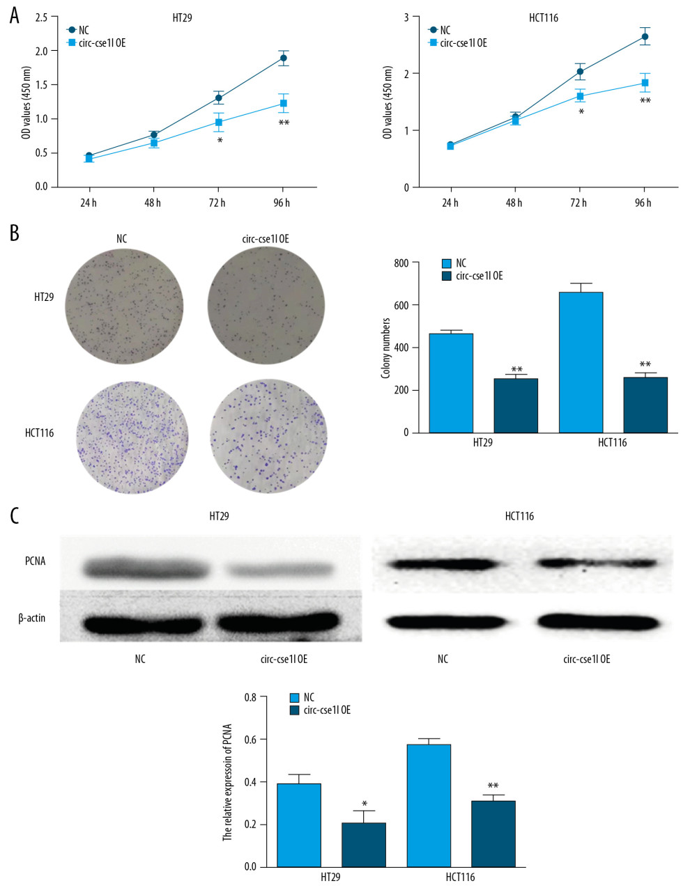 Overexpression of circ_cse1l inhibits CRC cell proliferation while reducing PCNA expression. HT29 and HCT116 cells were transfected with a circ_cse1l overexpression vector and an empty vector (NC). (A) CCK-8 and (B) colony formation assays, showing that overexpression of circ_cse1l inhibited the proliferation of HT29 and HCT116 cells. (C) Western blotting experiments, showing that circ_cse1l overexpression reduced the expression of PCNA protein in HT29 and HCT116 cells. * P<0.05, ** P<0.01.