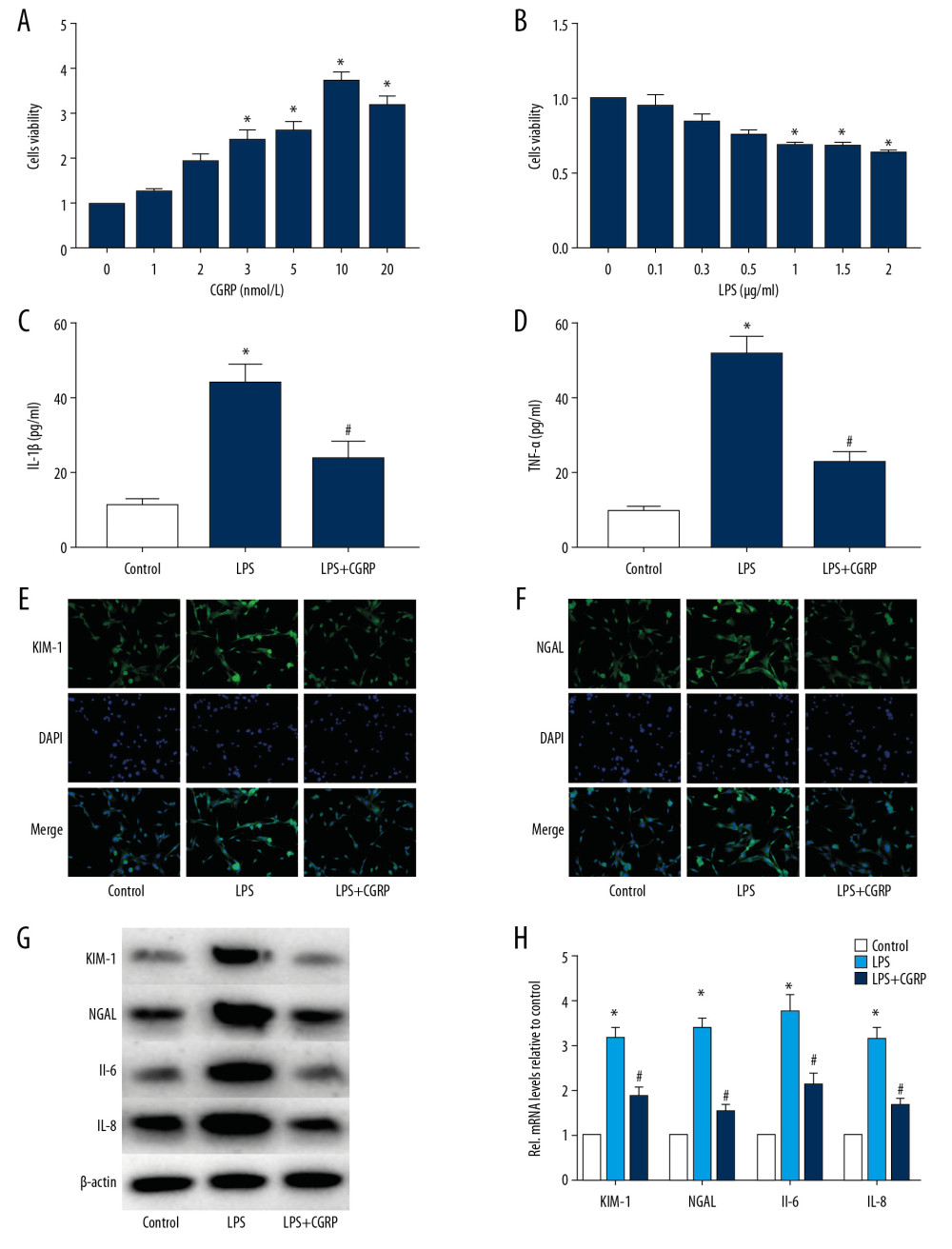 CGRP attenuates LPS-induced damage to HK-2 cells. (A) CCK8 assay of CGRP; (B) CCK8 assay of LPS; (C, D) ELISA results of IL-1β and TNF-α; (E, F) IF staining results of KIM-1 and NGAL (magnification×400); (G, H) Western blot and RT-PCR results of KIM-1, NGAL, IL-6 and IL-8. (* P<0.05 vs. the control group and # P<0.05 vs. the LPS group).