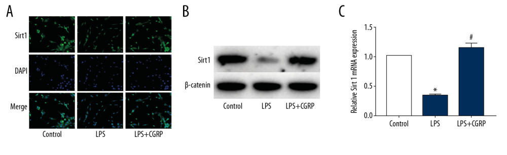 CGRP increases the expression of Sirt1 in HK-2 cells. (A) IF staining result of Sirt1 (magnification ×400); (B) Western blot result of Sirt1; (C) RT-PCR result of Sirt1. (* P<0.05 vs. the control group and # P<0.05 vs. the LPS group).