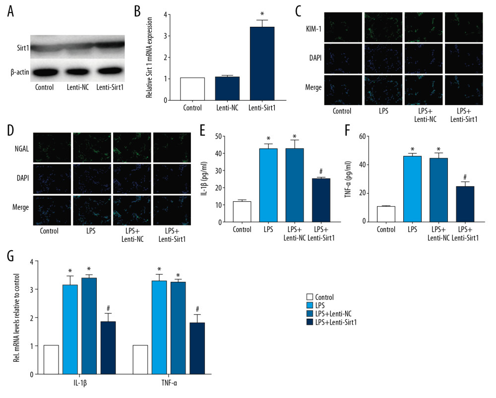 Overexpression of Sirt1 reduces damage and inflammation of HK-2 cells. (A, B) Western blot and RT-PCR results of Sirt1; (C, D) IF staining results of KIM-1 and NGAL (magnification×400); (E, F) ELISA results of IL-1β and TNF-α; (G) RT-PCR results of IL-1β and TNF-α. (* P<0.05 vs. the control group and # P<0.05 vs. the LPS+Lenti-NC group).