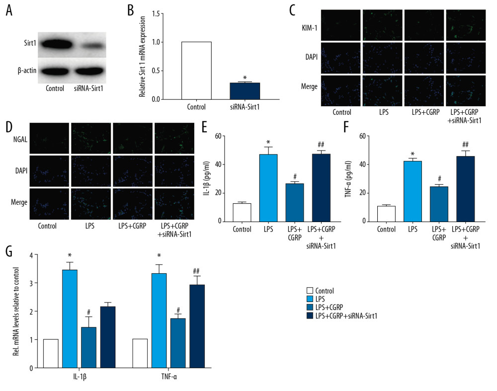 Silence of Sirt1 attenuates the protective effect of CGRP on HK-2 cells. (A, B) Western blot and RT-PCR results of Sirt1; (C, D) IF staining of KIM-1 and NGAL (magnification ×400); (E, F) ELISA results of IL-1β and TNF-α; (G) RT-PCR results of IL-1β and TNF-α. (* P<0.05 vs. the control group, # P<0.05 vs. the LPS group and ## P<0.05 vs. the LPS+CGRP group).