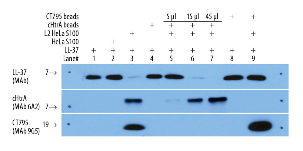 Ab purified endogenous cHtrA can cleave LL-37. LL-37 (2.5 μg) was the substrate in all groups. After incubation with 5, 15, and 45 μL of endogenous cHtrA, as well as the control groups, Western blot assay was performed. Note that the blank control, HeLa S100, untreated protein-G beads, and treated or untreated CT795 beads (coated with anti-CT795 antibodies) all revealed no cHtrA and high LL-37 concentrations, while purified and unpurified L2 HeLa S100 revealed strong cHtrA and weak LL-37 levels in a cHtrA-dose-dependent manner.