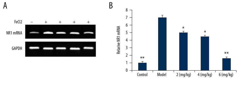 (A, B) Effect of PP-4-one on NR1 mRNA. We performed RT-PCR assay to assess NR1 mRNA levels in PTE-induced rats treated with PP-4-one or without treatment. * P<0.02 and ** P<0.02 vs. the vehicle-treated rats.