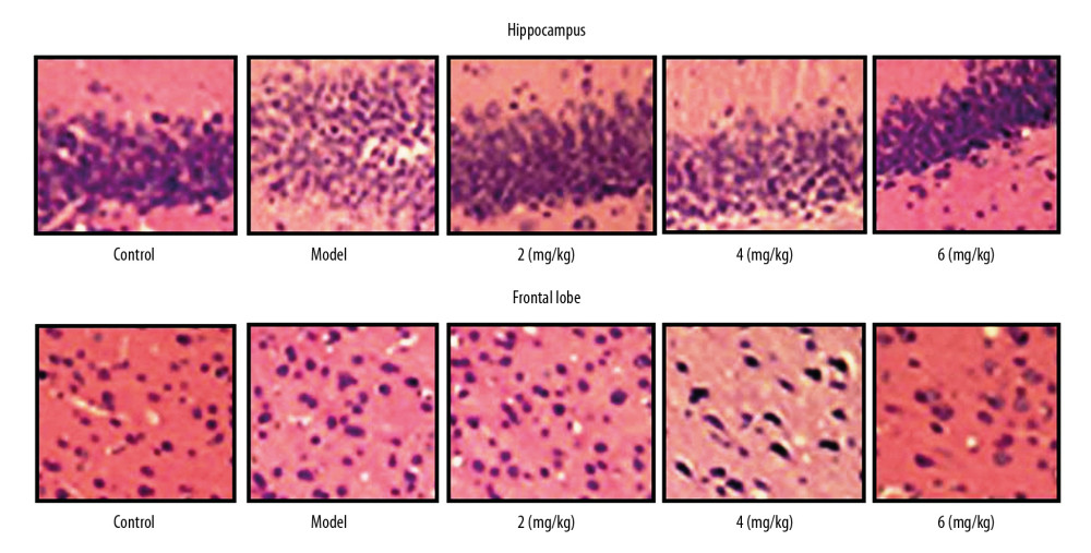 Effect of PP-4-one on PTE-mediated cell injury. We examined cellular impairment using immunohistochemistry in PTE rats treated with or without PP-4-one treatment (magnification ×400).