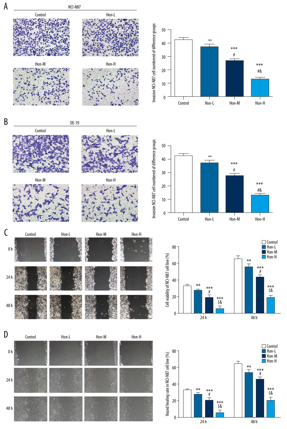Honokiol (Hon) affects cell invasion and wound-healing rate in NCI-N87 and OE-19 cell lines. Control: Untreated cells. Hon-L: Cells treated with low-dose Hon. Hon-M: Cells treated with middle-dose Hon. Hon-H: Cells treated with high-dose Hon. Invading cell numbers of different groups in NCI-N87 cell line (A) and in OE-19 cell line (B) by transwell assay (200×). Wound-healing rate of different groups in NCI-N87 cell line (C) and in OE-19 cell line (D) by wound-healing assay (100×). ** P<0.01, *** P<0.001 compared with control group; # P<0.05 compared with Hon-L group; & P<0.05 compared with Hon-M group.