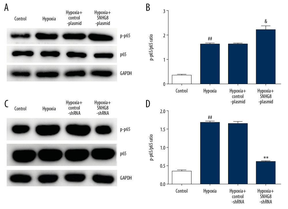 Effects of lncRNA SNHG8 on NF-κB signal pathway in hypoxia-induced cardiomyocytes. (A, C) Western blotting analysis was used to determine p-p65 and p65 protein expression in H9c2 cells. (B, D) p-p65/p65 ratio in hypoxia-induced cardiomyocytes following transfection. Control: cells without any treatment; Hypoxia: H9c2 cells were cultured under hypoxic conditions (94% N2, 5% CO2, and 1% O2) for 48 h; Hypoxia+control-plasmid: H9c2 cells were transfected with control-plasmid for 48 h under hypoxic conditions; Hypoxia+SNHG8-plasmid: H9c2 cells were transfected with SNHG8-plasmid for 48 h under hypoxic conditions. Hypoxia+control-shRNA: H9c2 cells were transfected with control-shRNA for 48 h under hypoxic conditions; Hypoxia+SNHG8-shRNA: H9c2 cells were transfected with SNHG8-shRNA for 48 h under hypoxic conditions. ## P<0.01 vs. Control group; & P<0.05 vs. Hypoxia+control-plasmid; ** P<0.01 vs. Hypoxia+control-shRNA.