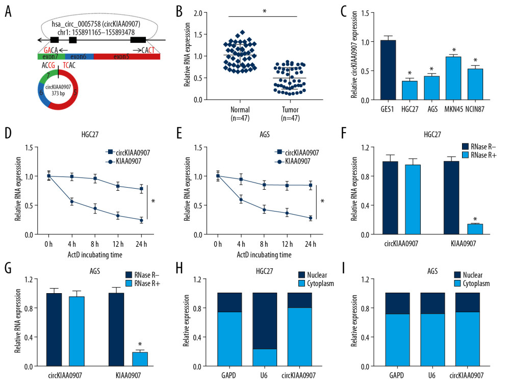 CircKIAA0907 expression was lessened in gastric cancer (GC) tissues and cells. (A) Genomic location of KIAA0907 gene and circKIAA0907. (B, C) Level of circKIAA0907 was assayed using quantitative real-time polymerase chain reaction (qRT-PCR) in GC tissues (B) and cells (C). (D–G) qRT-PCR analysis of circKIAA0907 and KIAA0907 was implemented in HGC27 and AGS cells after treatment with actinomycin D (D, E) and RNase R (F, G). (H, I) CircKIAA0907 localization was analyzed through comparison with glyceraldehyde-3-phosphate dehydrogenase (GAPDH) and U6 via qRT-PCR detection. * P<0.05.