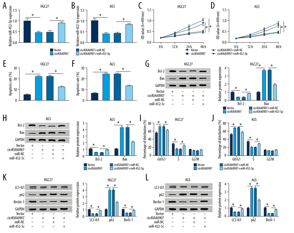 Increase of miR-452-5p reversed the inhibition of circKIAA0907 on the progression of gastric cancer (GC) cells. (A, B) After transfection of vector, circKIAA0907, circKIAA0907+miR-NC, and circKIAA0907+miR-452-5p in HGC27 and AGS cells, the expression of miR-452-5p was assayed via quantitative real-time polymerase chain reaction (qRT-PCR). (C, D) 3-(4, 5-Dimethylthiazol-2-y1)-2, 5-diphenyl tetrazolium bromide (MTT) assay was used for measuring proliferation ability in transfected cells. (E–H) Cell apoptosis was assessed with flow cytometry and western blot. (I, J) The percentage of each phase in transfected GC cells was examined by cell cycle detection. (K, L) Evaluation of autophagy was carried out by detecting associated proteins after western blot. * P<0.05.
