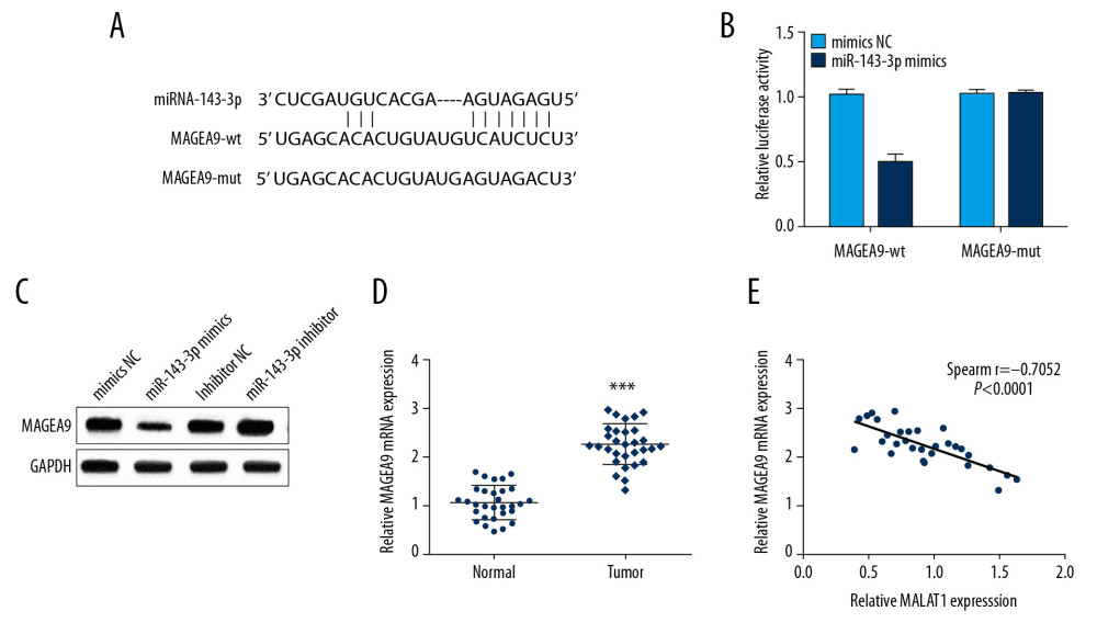 miR-143-3p regulates MAGEA9 expression in OSCC. (A) Putative target sites of miR-143-3p and MAGEA9. (B) Luciferase activity in CAL-27 cells after MAGEA9-wt or MAGEA9-mut and mimics NC or miR-143-3p mimics co-transfection. (C) MAGEA9 protein levels in CAL-27 cells. (D) MAGEA9 mRNA expression in tissue samples. (E) The correlation of miR-143-3p and MAGEA9 in OSCC tissues. ** P<0.01.