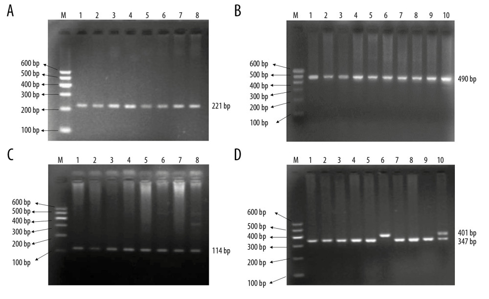The electrophoresis results of the PCR products of (A) rs1801260, (B) rs6850524, (C) rs2304672, and (D) Per3. For the Per3 gene, Lanes 1–5 and 7–9 were 4/4 genotype, Lane 6 was 5/5 genotype, and Lane 10 was 4/5 genotype.