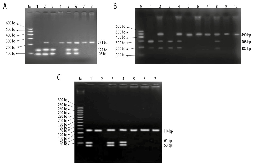 The electrophoresis results for restriction endonuclease digestion. (A) rs1801260; Lanes 1 and 3 were CT genotype, Lanes 2, 5, and 6 were CC genotype, and Lanes 4, 7, and 8 were TT genotype. (B) rs6850524; Lanes 1 and 3 were GG genotype, Lanes 2, 4, and 8 were GC genotype, and Lanes 5–7 and 9–10 were CC genotype. (C) rs2304672; Lanes 1, 3, and 4 were CG genotype, and Lanes 2 and 5–7 were CC genotype.