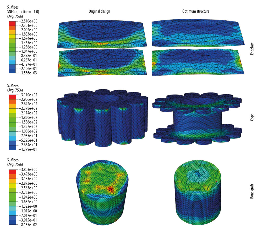 The stress distribution on endplates, cages, and bone grafts for original cage and optimum structural one.