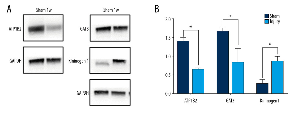 Western blotting of differentially expressed proteins (DEPs). (A) Expression of T-kininogen 1 (Kng1), sodium- and chloride-dependent GABA transporter 3 (Gat3) and sodium/potassium-transporting ATPase subunit beta (Atp1b2) in the SCI and control groups of rats. GAPDH levels were loading control. (B) Quantification of expression of DEPs. * P<0.05.